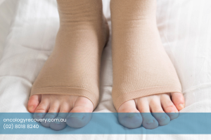 compression stockings for lymphoedema management 