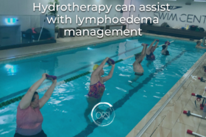 Hydrotherapy for Lymphoedema Management | Oncology Recover Services Sydney