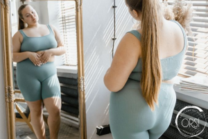 What is Lipoedema
